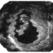 Geometric expression illustration